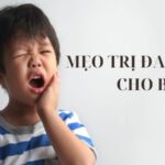 Mẹo Trị Đau Răng Cho Bé