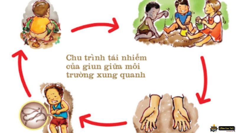 mẹo chữa đau bụng giun