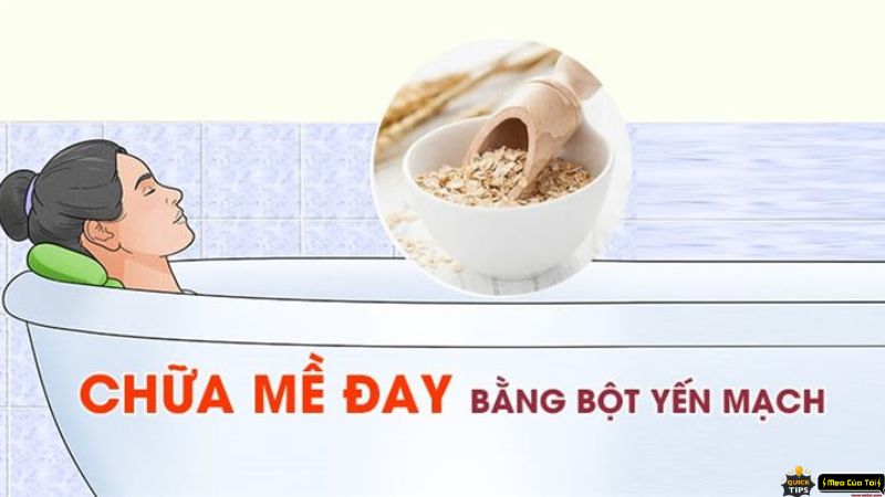 mẹo chữa mề đay cho bà bầu